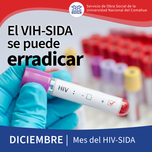 El VIH-SIDA se puede erradicar 